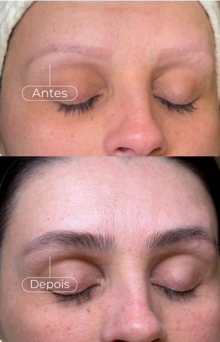 Antes e depois de sobrancelhas